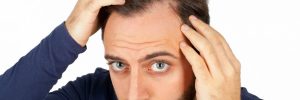 Root causes of a receding hairline