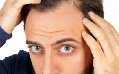 What Are The Root Causes Of A Receding Hairline Venus Hair