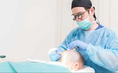 Preparing For Your Hair Transplant; Instructions.