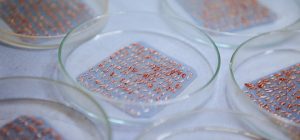 Graft Hair Transplant grafts