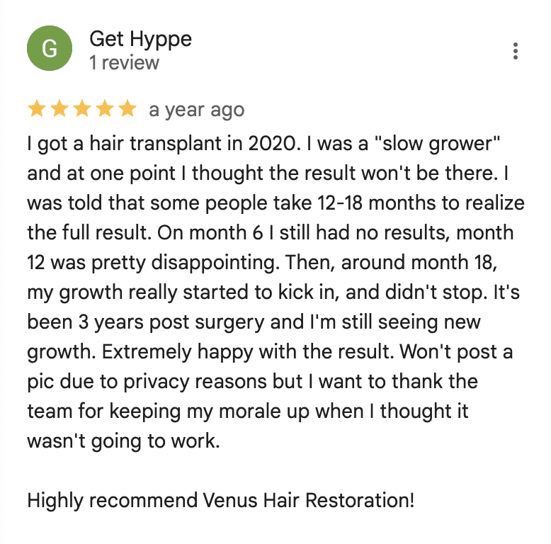 FUE Hair transplant review