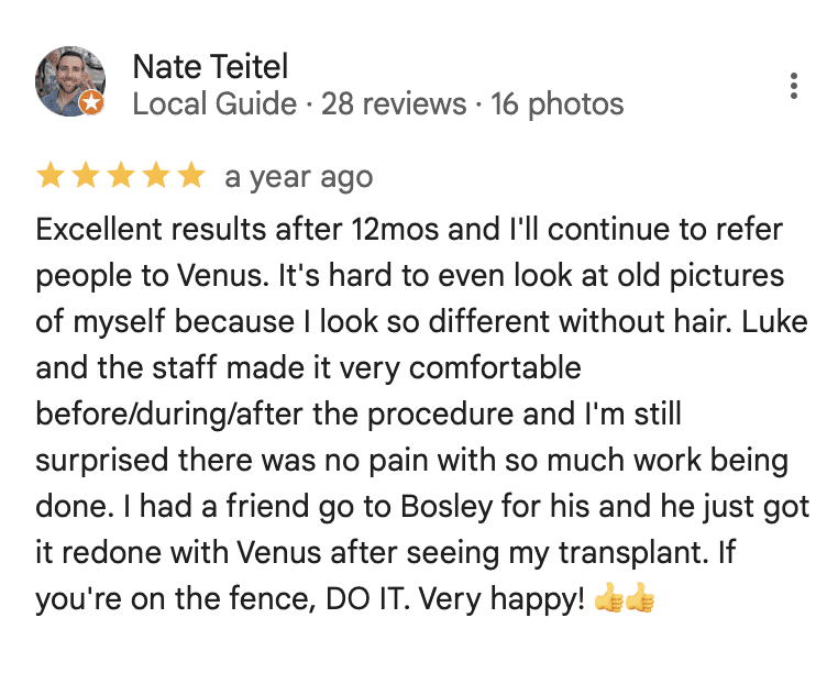 Venus hair restoration review
